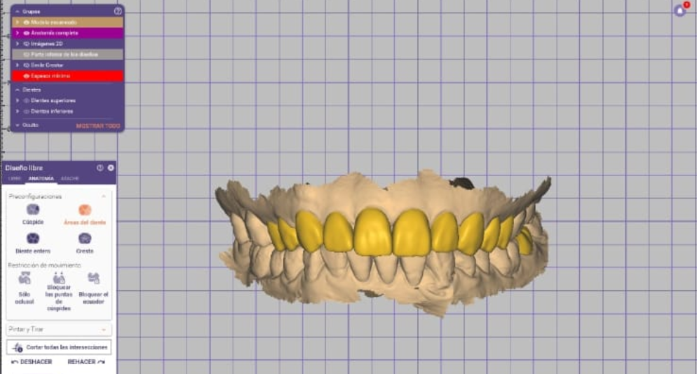 Tecnología de escaneo